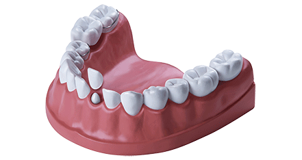 Zahnbehandlung Zahnersatz